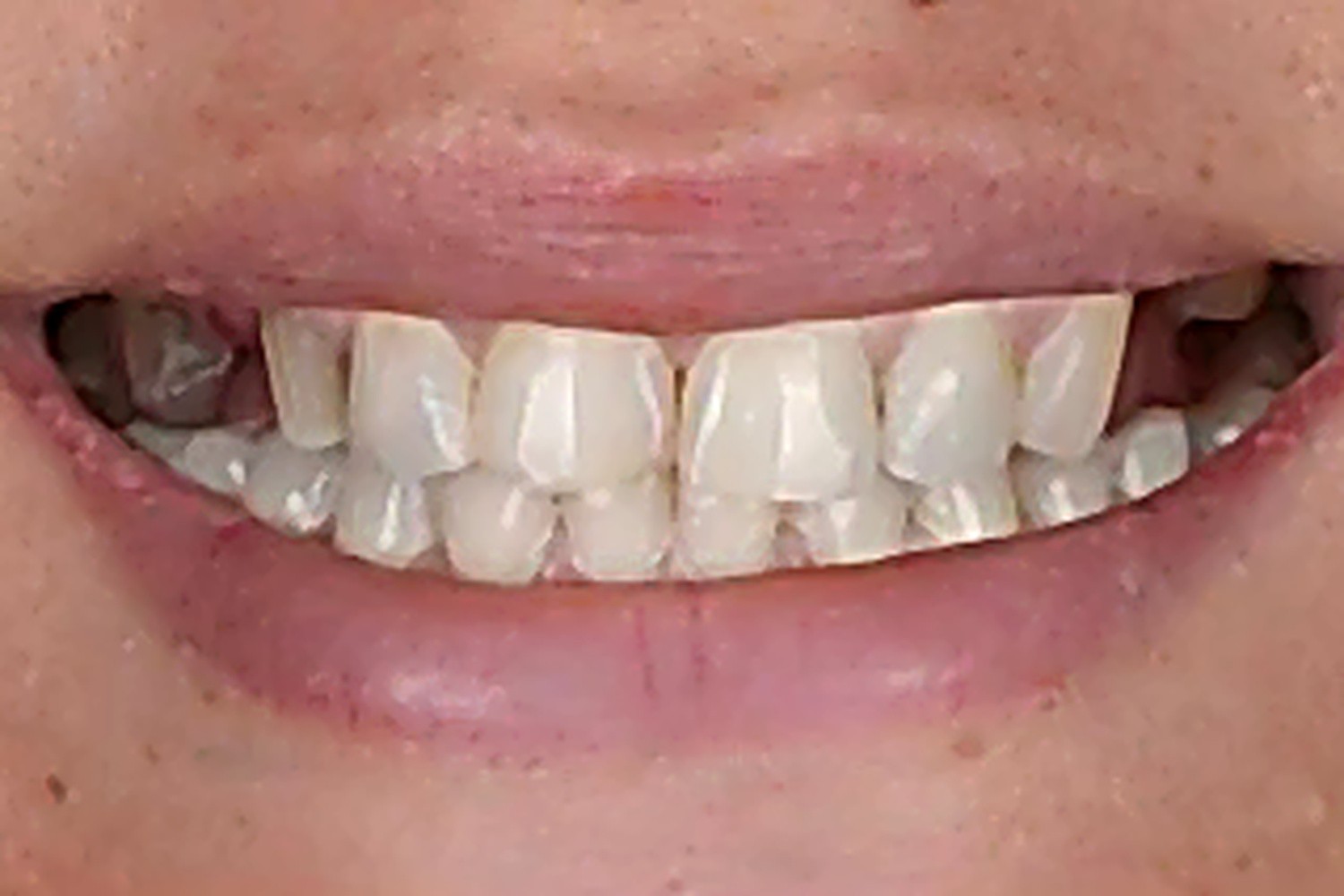 Before — Cosmetic Dentistry